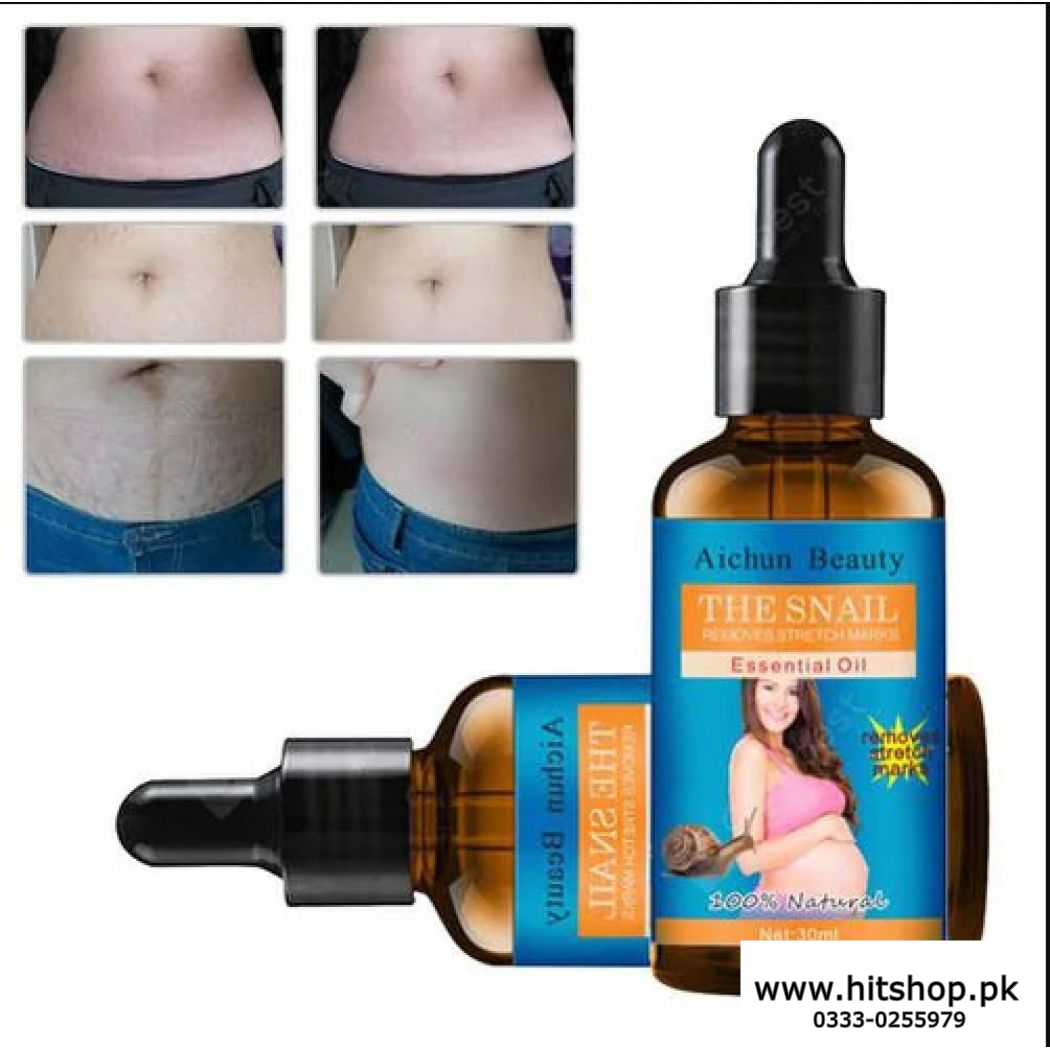 Stretch Marks Remover 